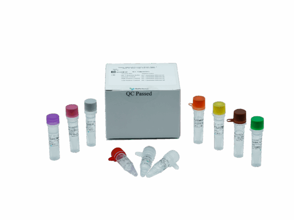Kit de RT-PCR Quantitative HIV-1 (RUO)