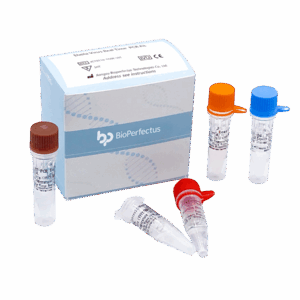 Kit de PCR vírus do Ebola em tempo real